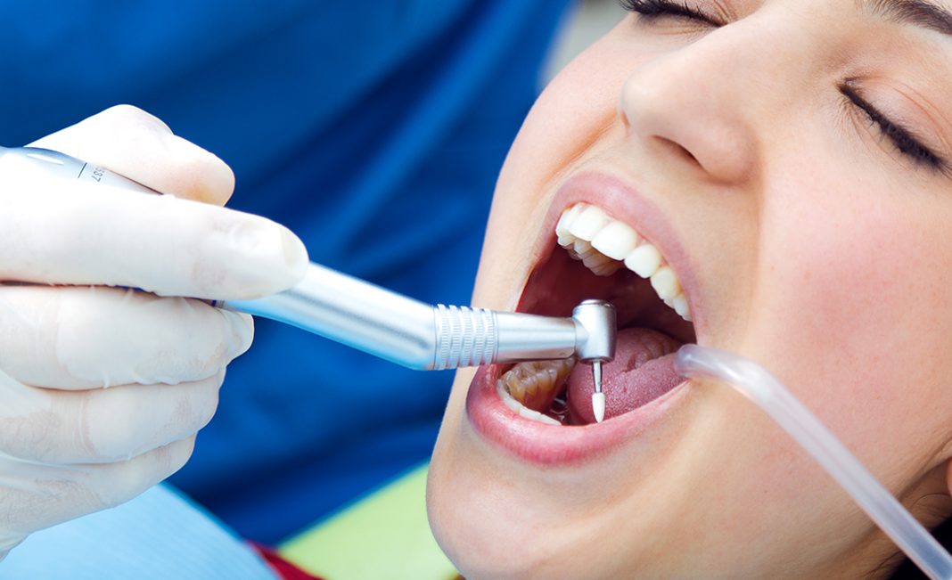 Is Deep cleaning Teeth Necessary and how much it costs Doctor ASKY