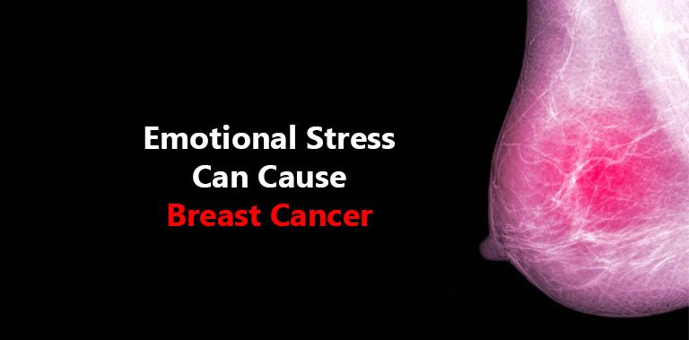 Emotional stress can cause Breast Cancer