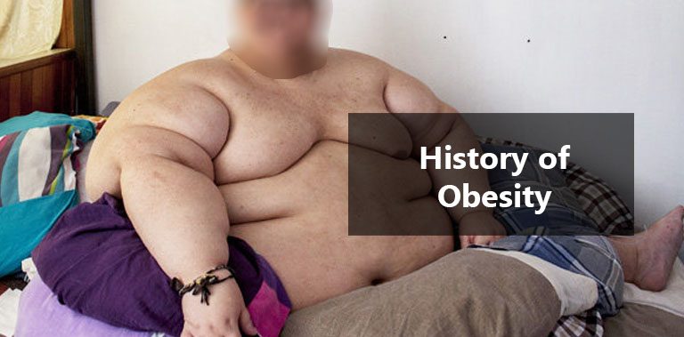 History of Obesity