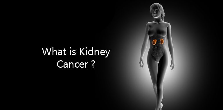 What is Kidney Cancer ?