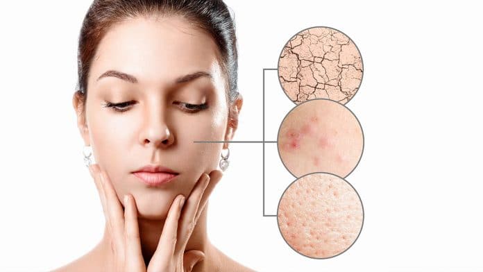 Top 10 Tips To Treat Dry Skin