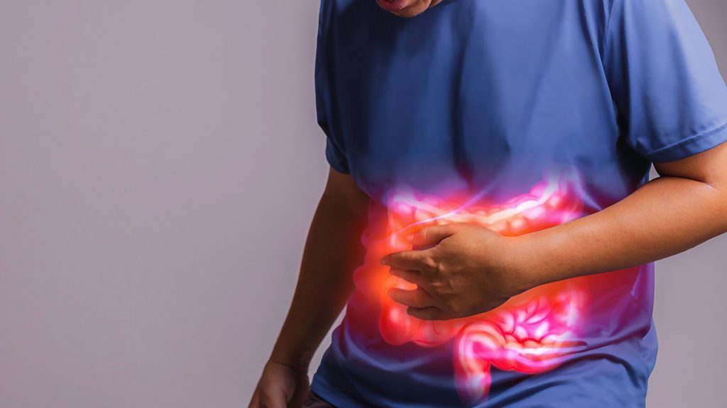 How To Prevent And Treat Colon Cancer? Doctor ASKY